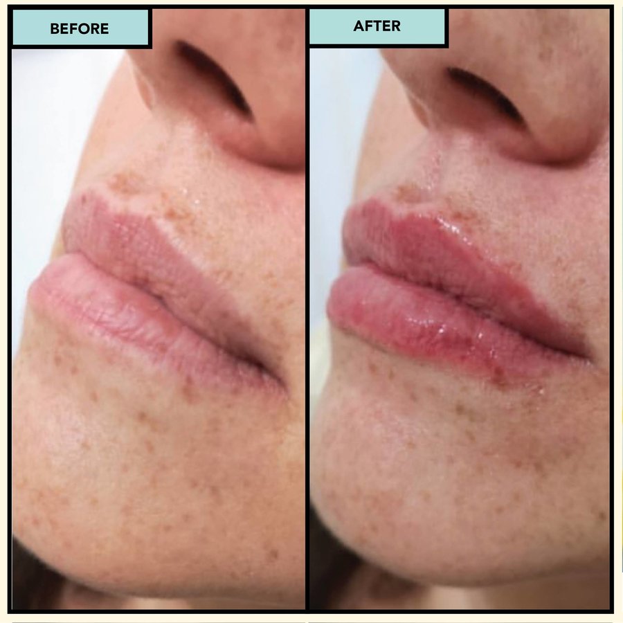 SISU Aesthetic Clinic - Dublin 2 - SISU Aesthetic Clinic - Dublin 2