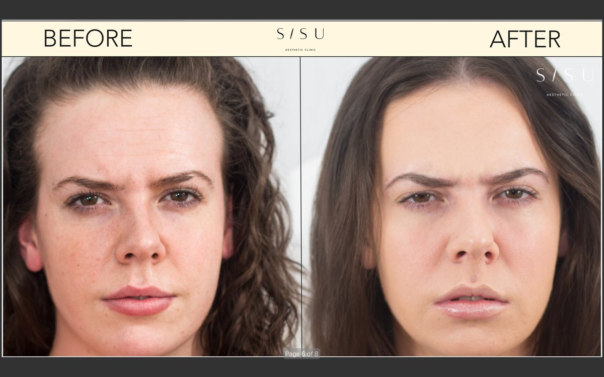 SISU Aesthetic Clinic - Dublin 2 - SISU Aesthetic Clinic - Dublin 2