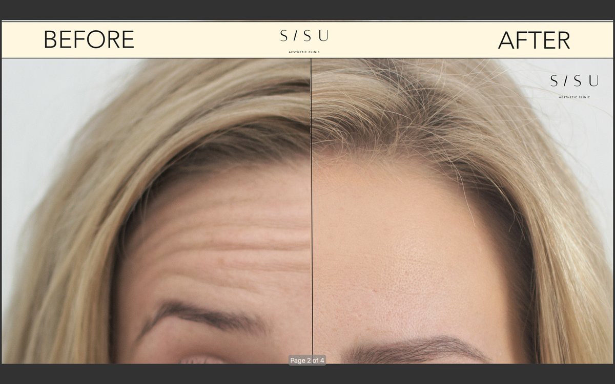 SISU Aesthetic Clinic - Dublin 2 - SISU Aesthetic Clinic - Dublin 2