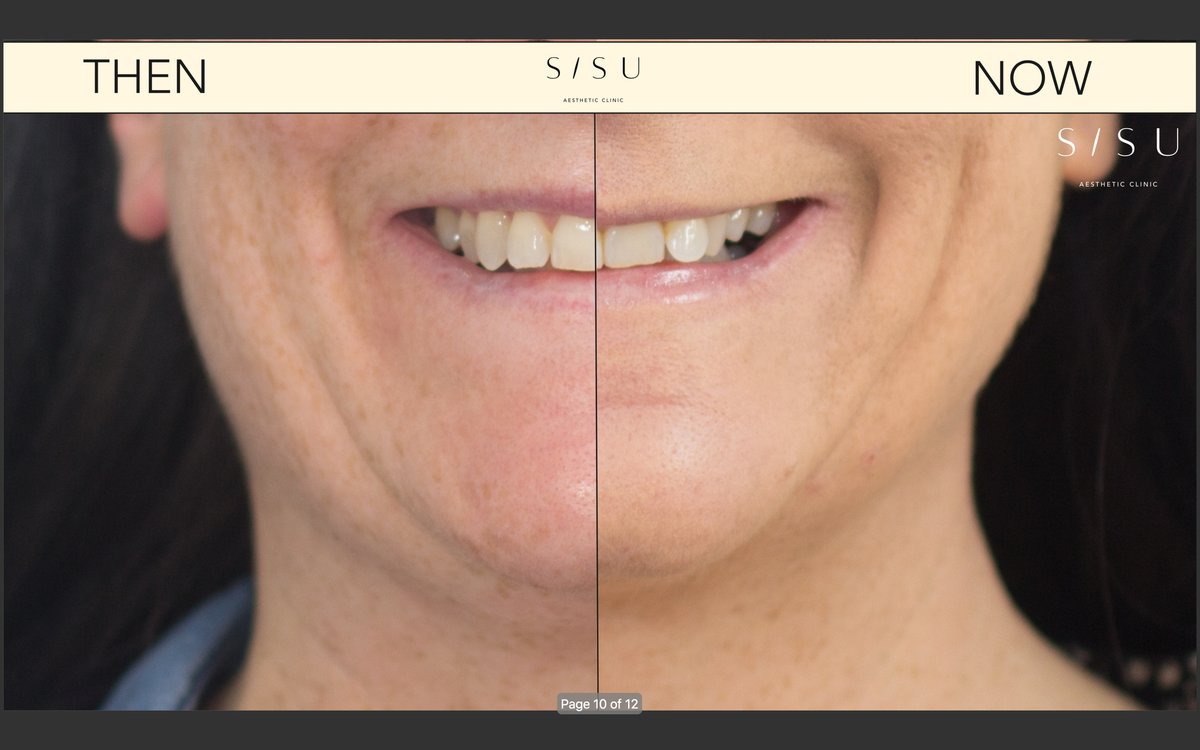 SISU Aesthetic Clinic - Dublin 2 - SISU Aesthetic Clinic - Dublin 2