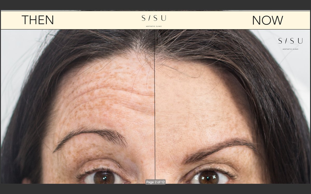 SISU Aesthetic Clinic - Dublin 2 - SISU Aesthetic Clinic - Dublin 2