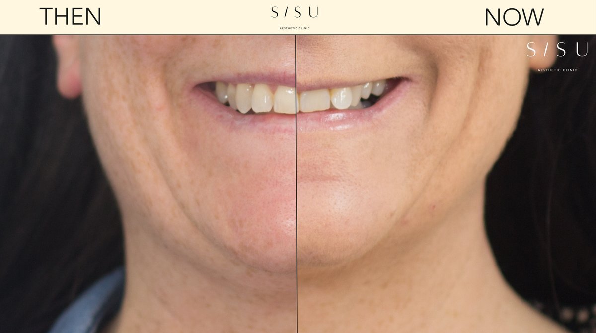 SISU Aesthetic Clinic - Killarney - SISU Aesthetic Clinic - Killarney