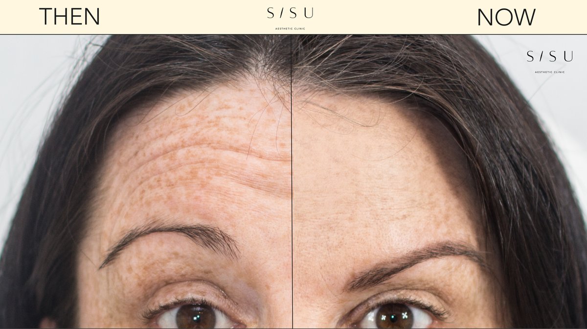 SISU Aesthetic Clinic - Killarney - SISU Aesthetic Clinic - Killarney