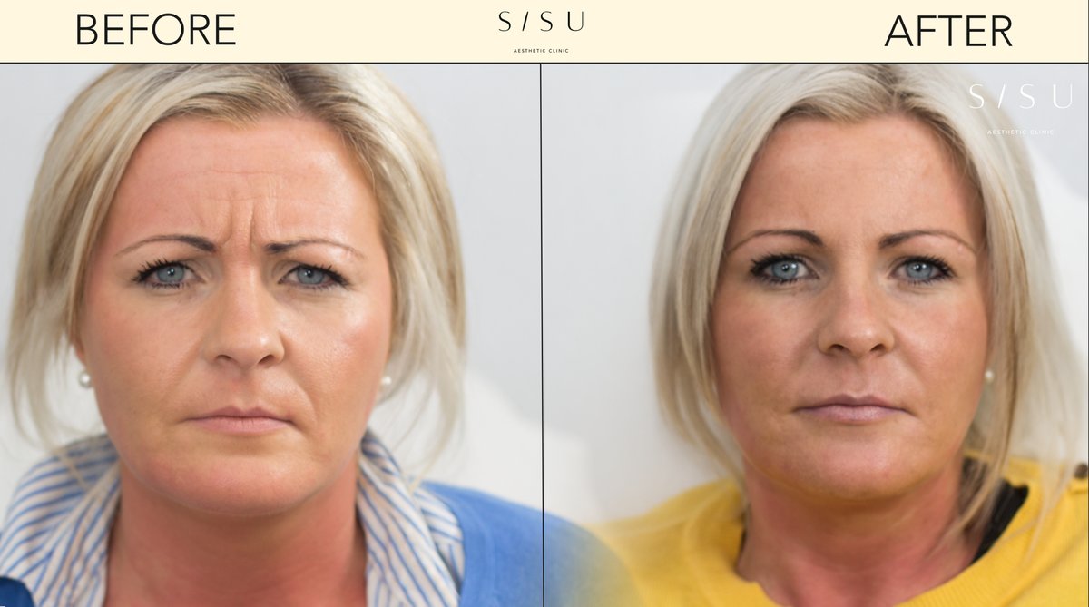 SISU Aesthetic Clinic - Killarney - SISU Aesthetic Clinic - Killarney