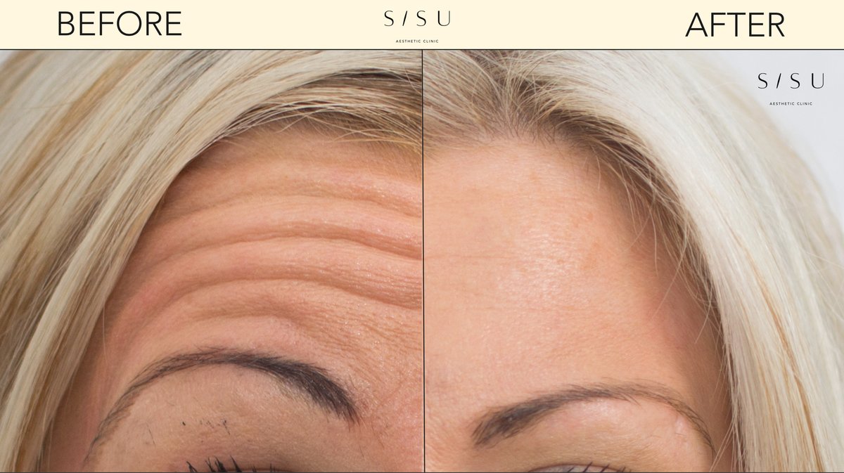 SISU Aesthetic Clinic - Killarney - SISU Aesthetic Clinic - Killarney