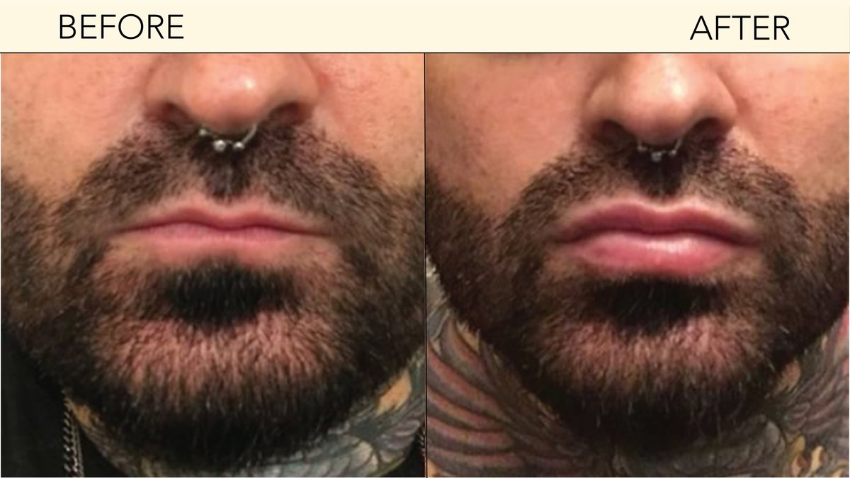 SISU Aesthetic Clinic - Killarney - SISU Aesthetic Clinic - Killarney