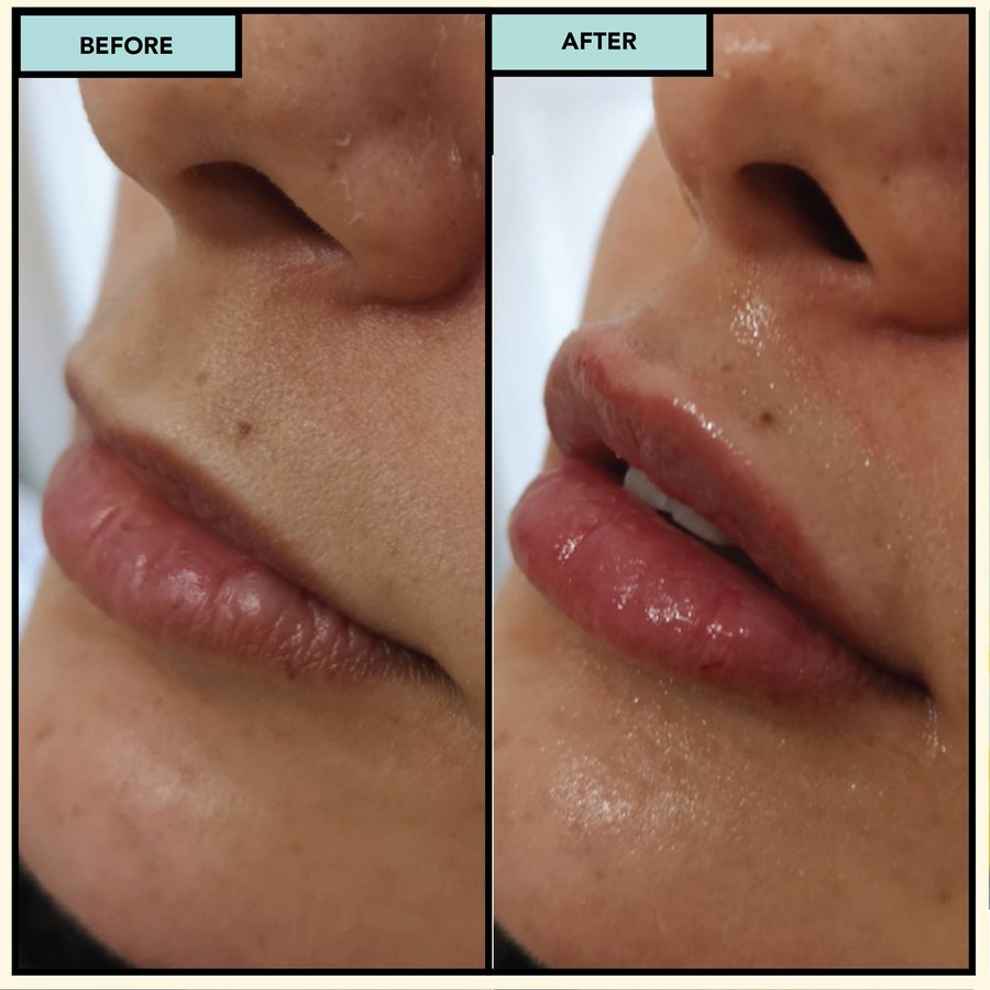 SISU Aesthetic Clinic - Killarney - SISU Aesthetic Clinic - Killarney