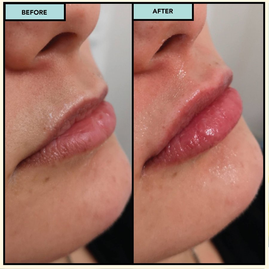 SISU Aesthetic Clinic - Killarney - SISU Aesthetic Clinic - Killarney