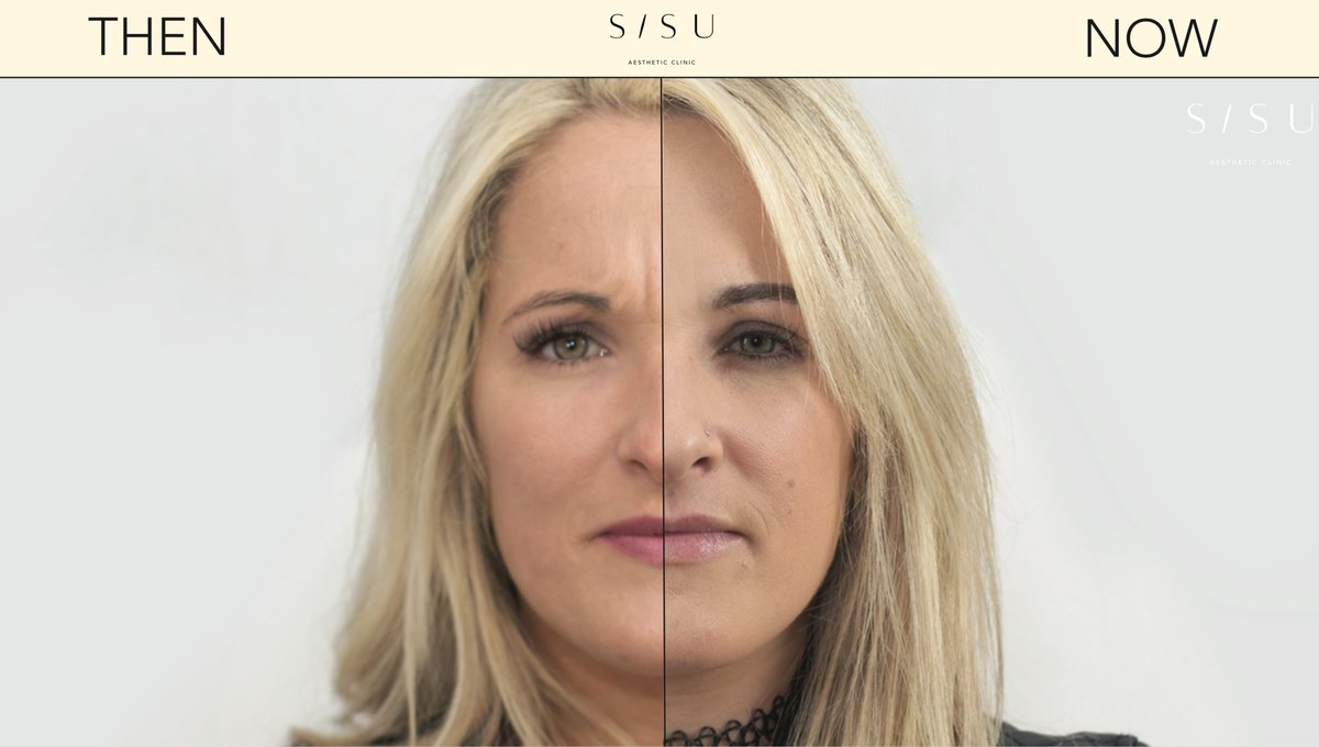 SISU Aesthetic Clinic - Killarney - SISU Aesthetic Clinic - Killarney