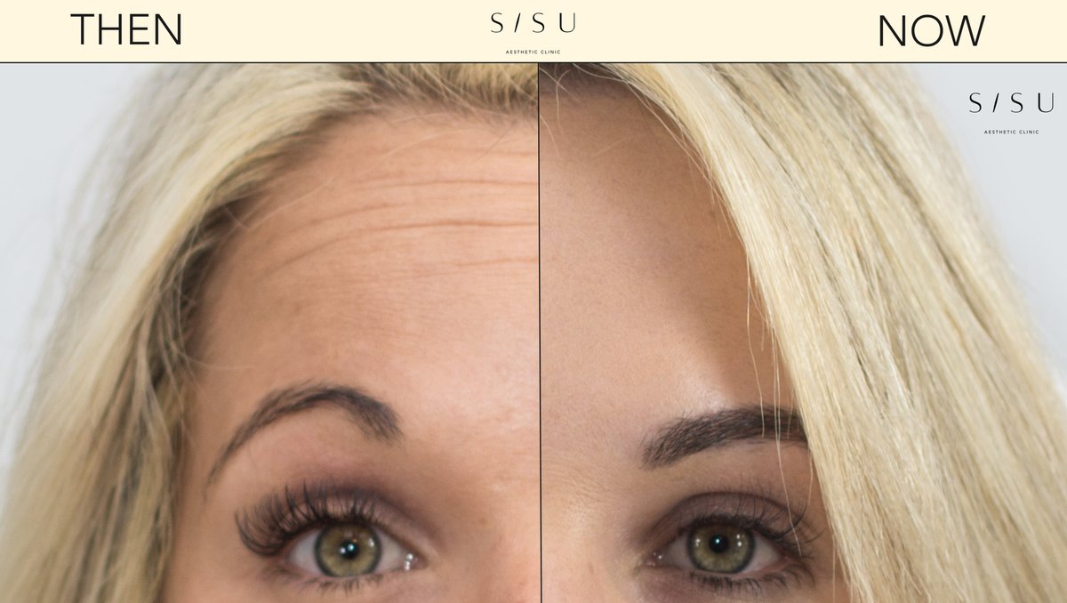 SISU Aesthetic Clinic - Killarney - SISU Aesthetic Clinic - Killarney