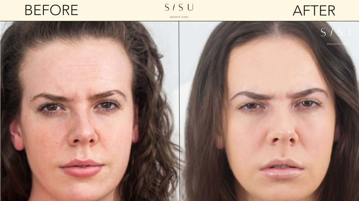SISU Aesthetic Clinic - Killarney - SISU Aesthetic Clinic - Killarney