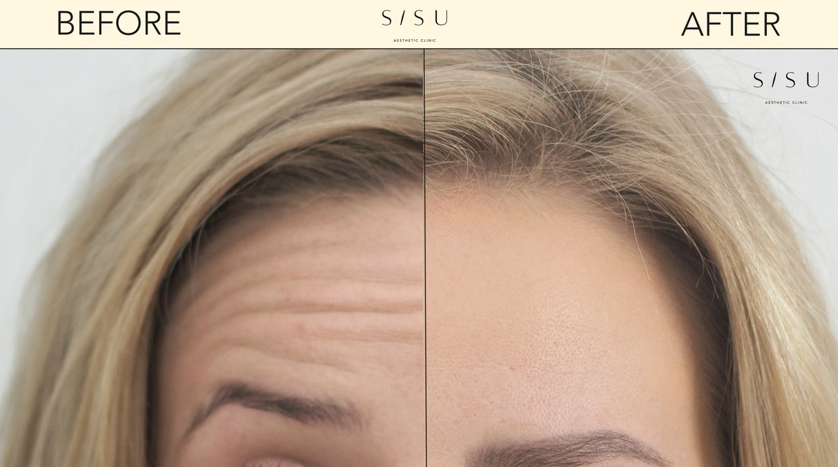 SISU Aesthetic Clinic - Killarney - SISU Aesthetic Clinic - Killarney