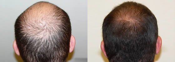 Sizzling Hair Care - Sizzling Hair Care