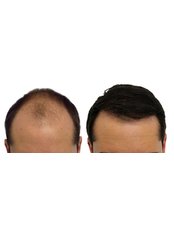 Sizzling Hair Care - Sizzling Hair Care
