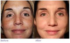 skin aesthetique - skin aesthetique