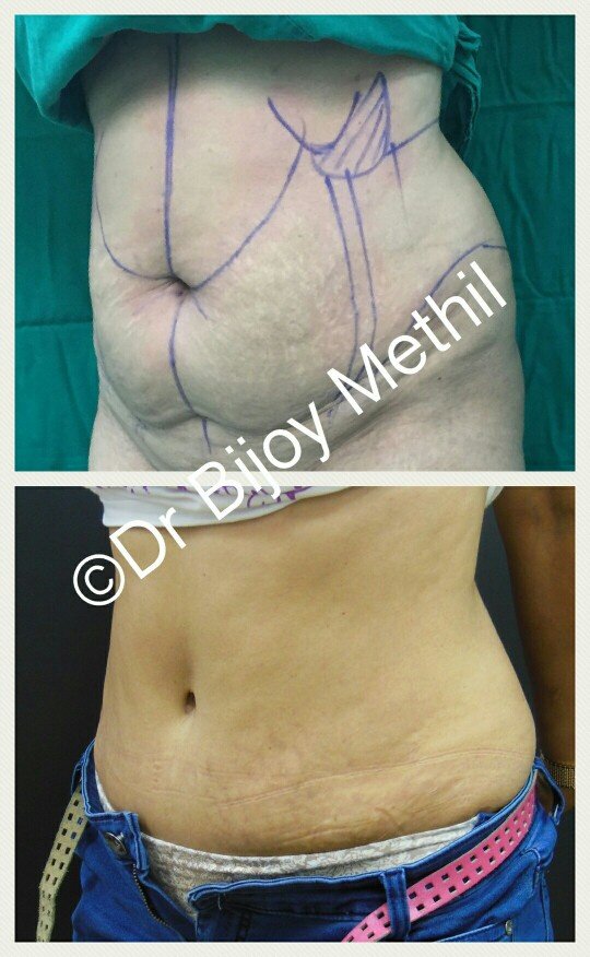 Skin and Shape Clinic - Skin and Shape Clinic