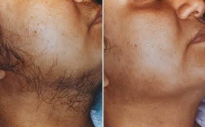 Skin, Body and Beauty Improvements Clinic - Skin, Body and Beauty Improvements Clinic