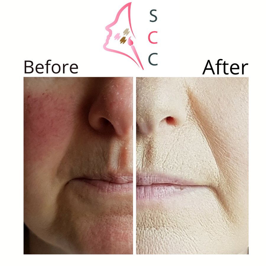 Skin Camouflage Care - Skin Camouflage Care