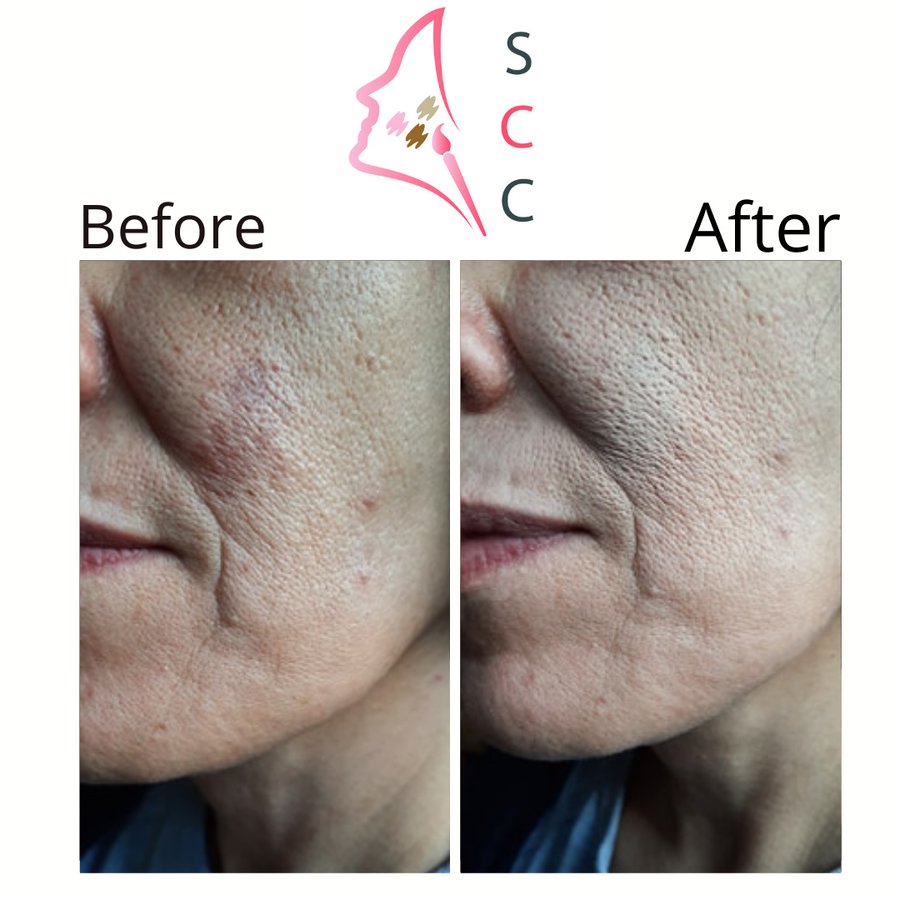 Skin Camouflage Care - Skin Camouflage Care