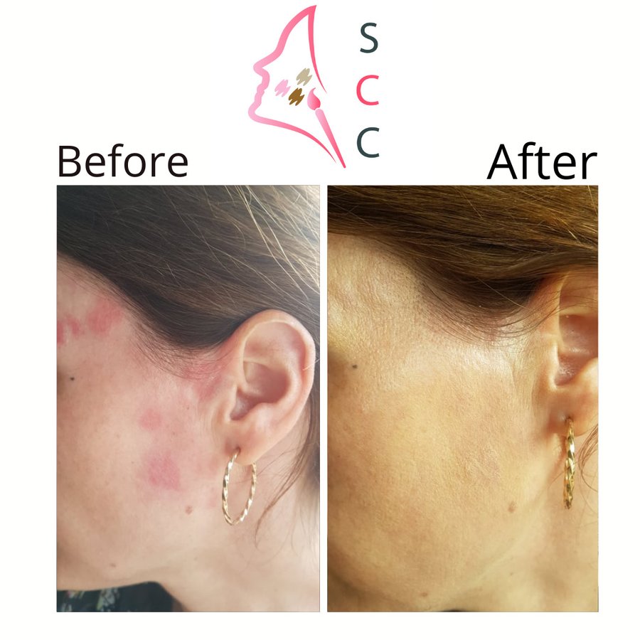 Skin Camouflage Care - Skin Camouflage Care