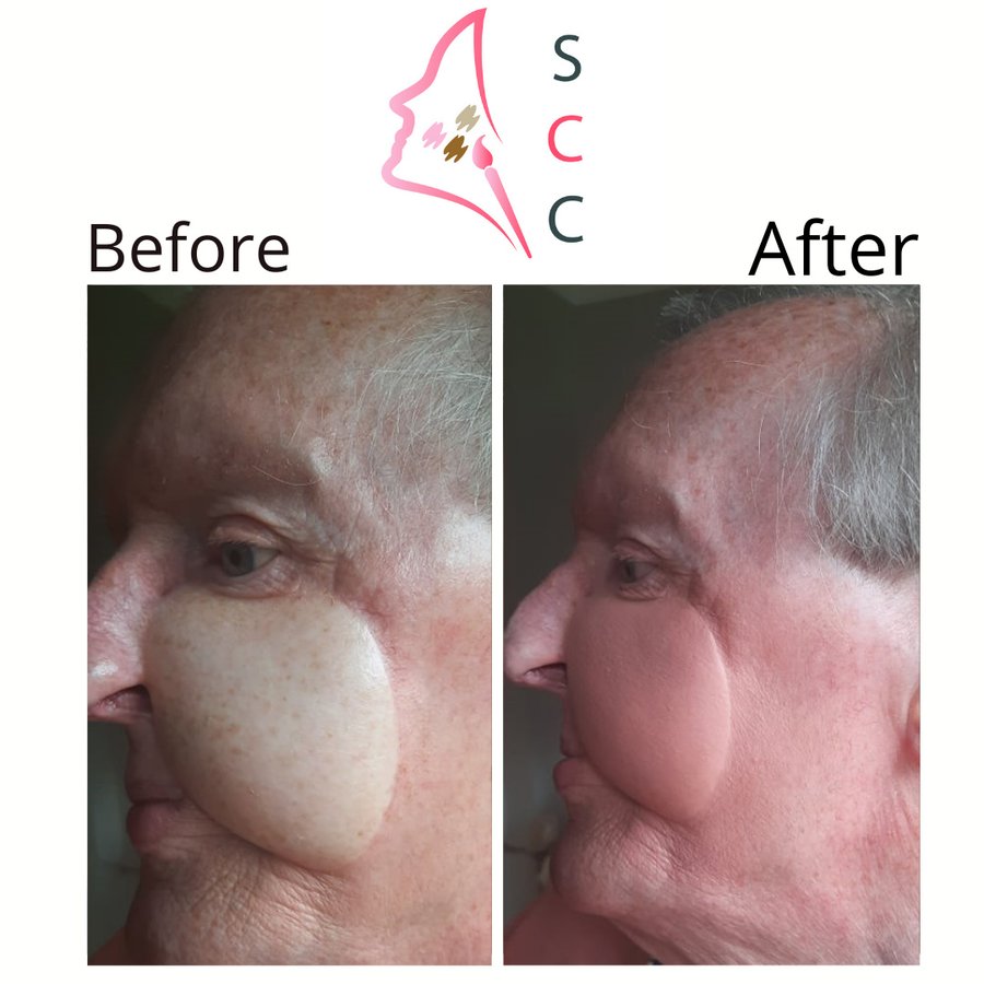 Skin Camouflage Care - Skin Camouflage Care