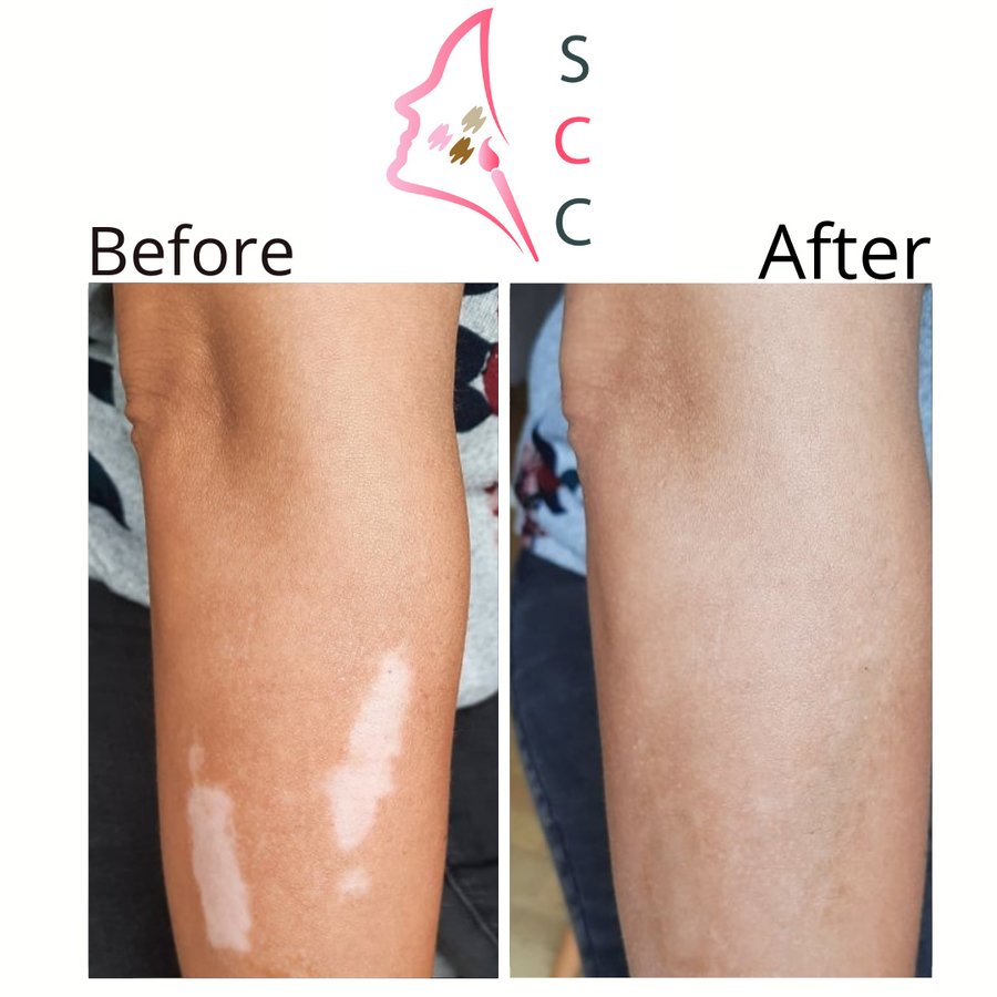 Skin Camouflage Care - Skin Camouflage Care