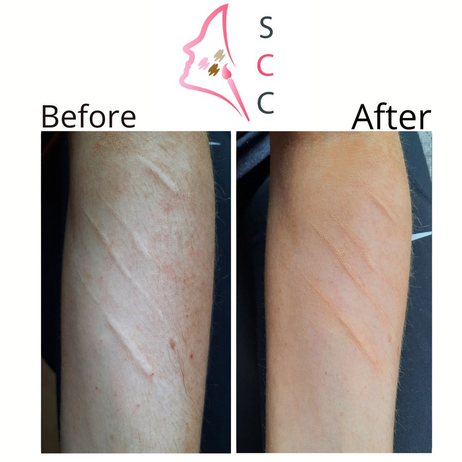 Skin Camouflage Care - Skin Camouflage Care