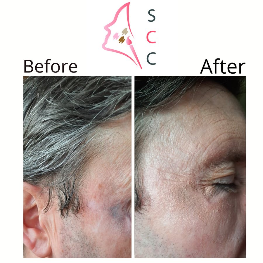 Skin Camouflage Care - Skin Camouflage Care