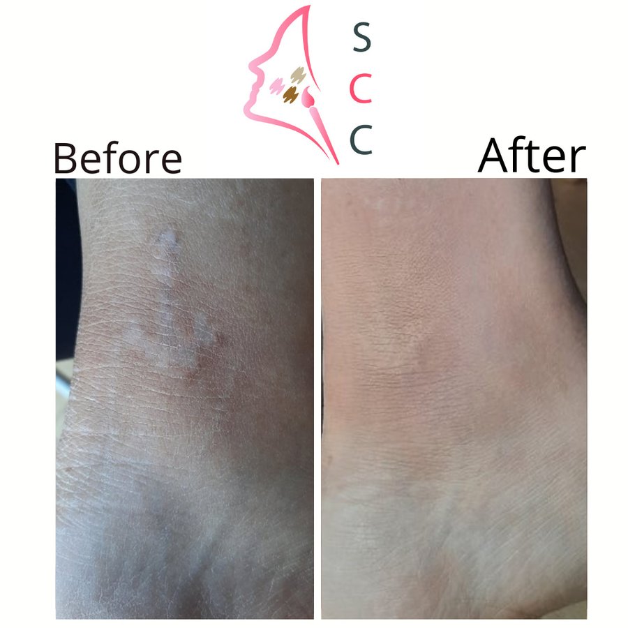 Skin Camouflage Care - Skin Camouflage Care