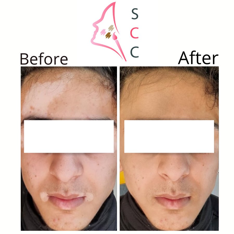 Skin Camouflage Care - Skin Camouflage Care