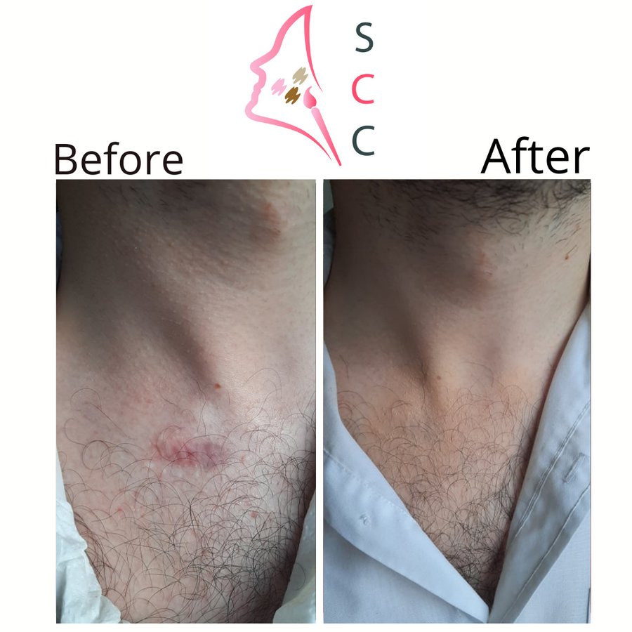 Skin Camouflage Care - Skin Camouflage Care