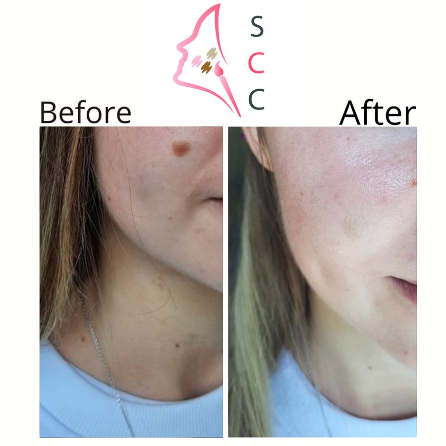 Skin Camouflage Care - Skin Camouflage Care