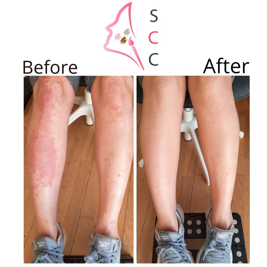 Skin Camouflage Care - Skin Camouflage Care