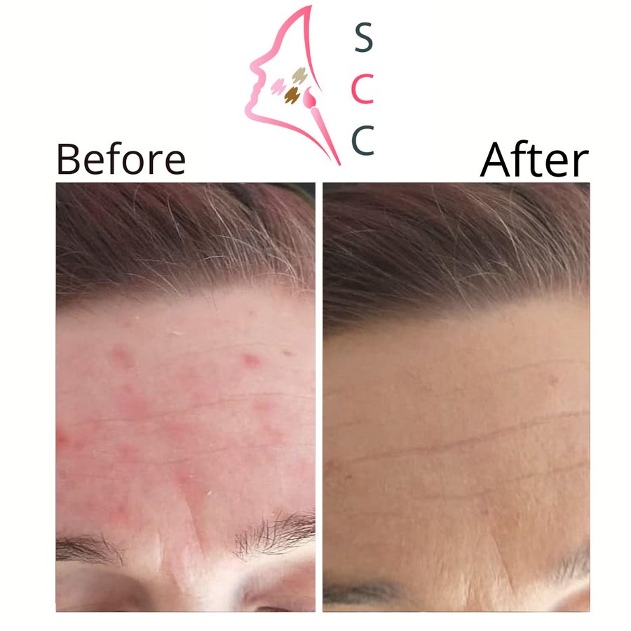 Skin Camouflage Care - Skin Camouflage Care