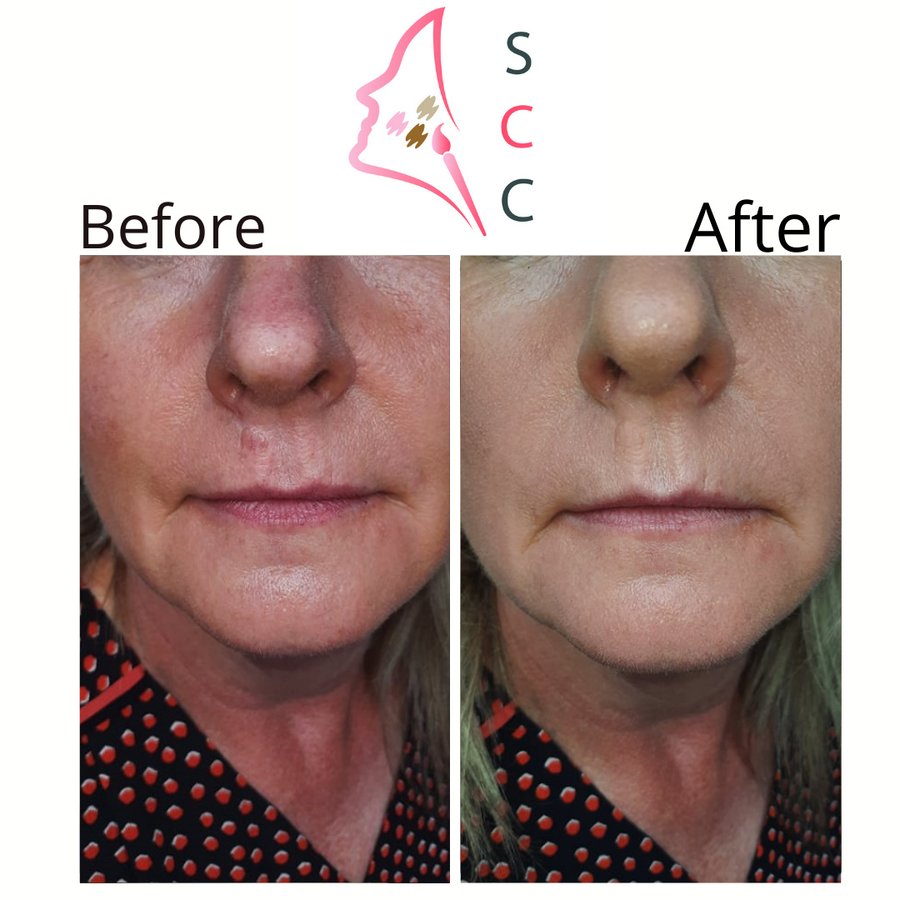 Skin Camouflage Care - Skin Camouflage Care