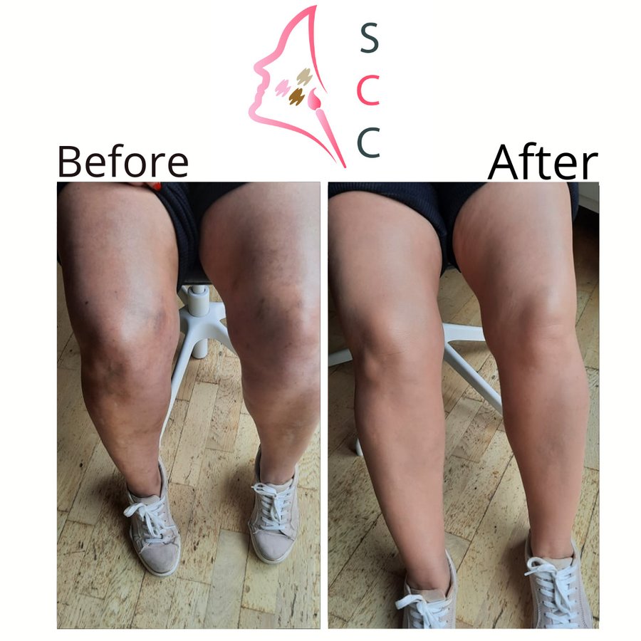 Skin Camouflage Care - Skin Camouflage Care