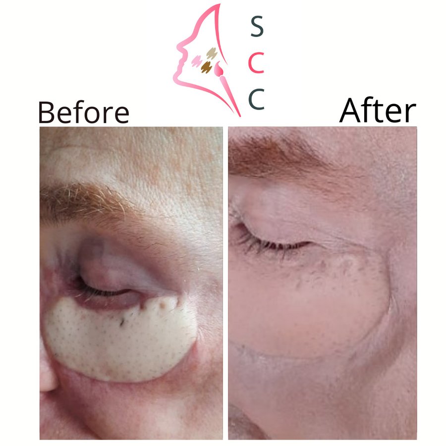 Skin Camouflage Care - Skin Camouflage Care