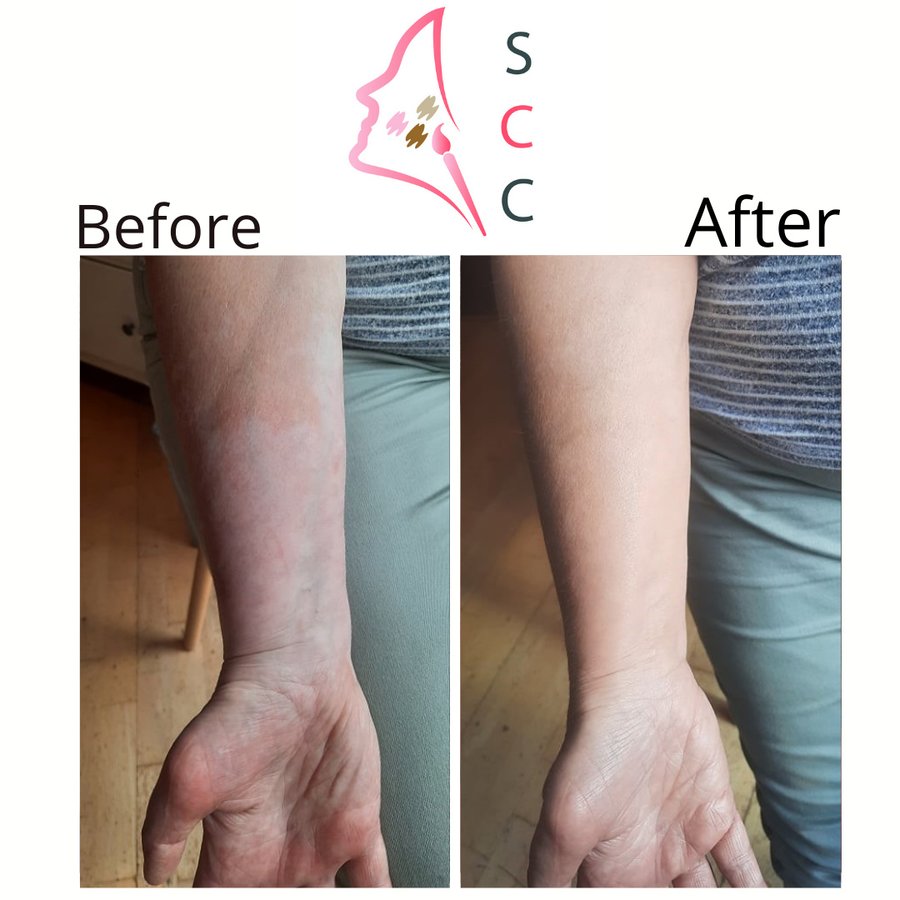 Skin Camouflage Care - Skin Camouflage Care