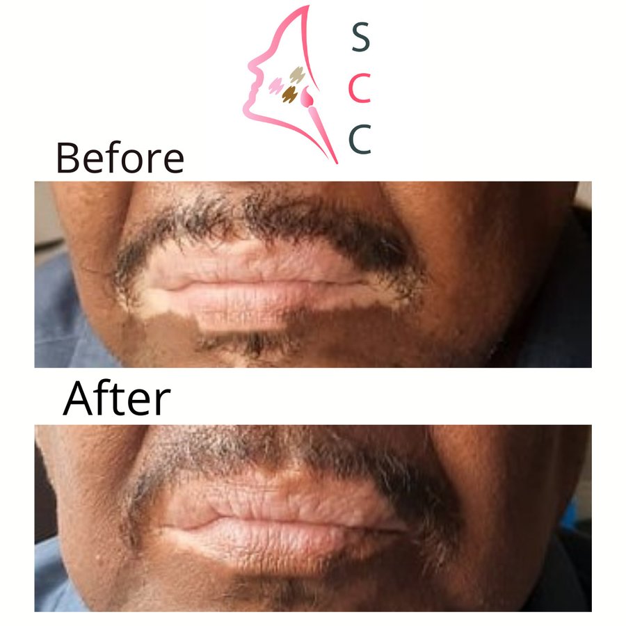 Skin Camouflage Care - Skin Camouflage Care