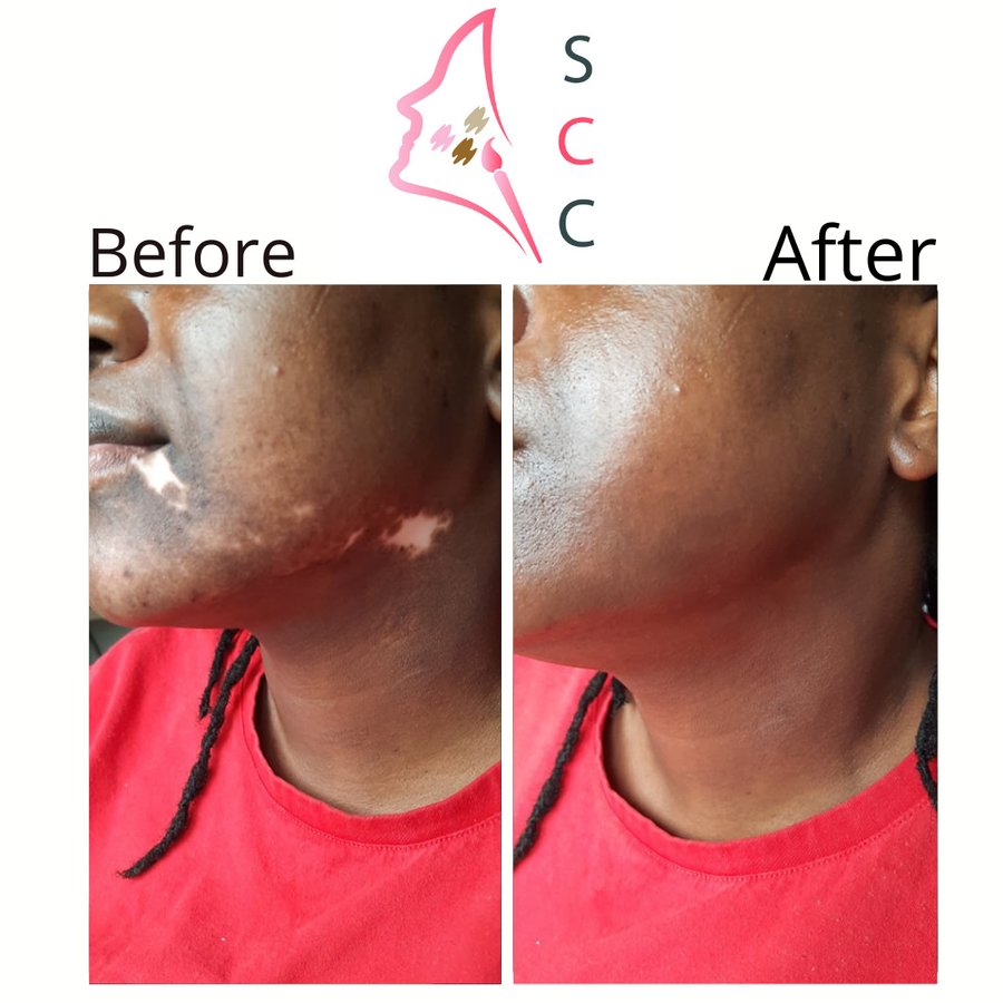 Skin Camouflage Care - Skin Camouflage Care