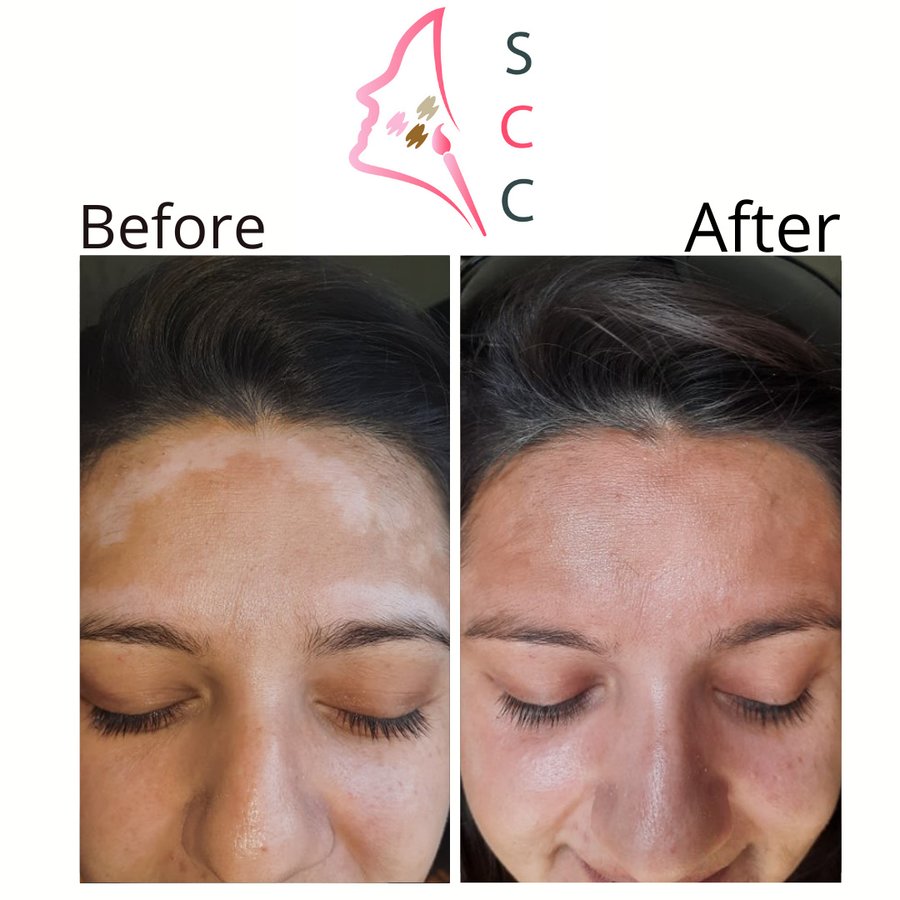 Skin Camouflage Care - Skin Camouflage Care