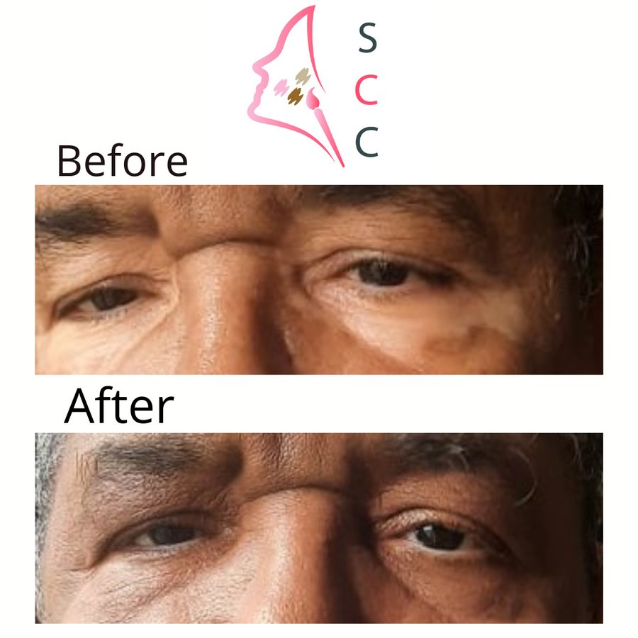 Skin Camouflage Care - Skin Camouflage Care