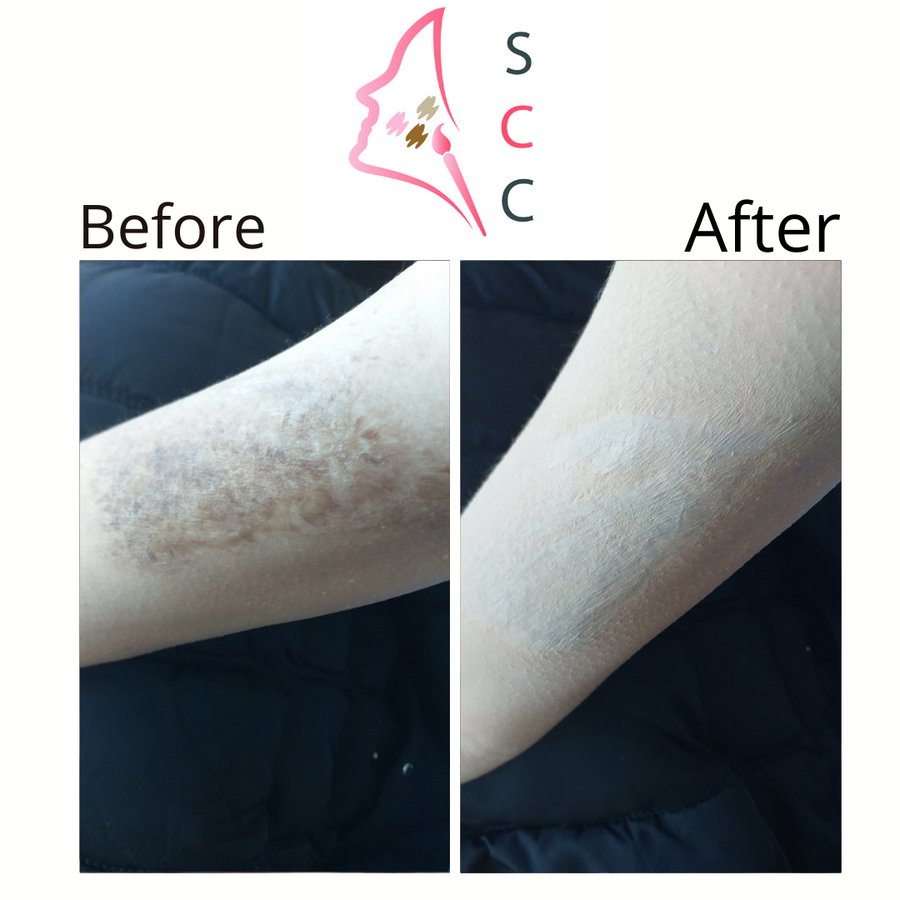 Skin Camouflage Care - Skin Camouflage Care