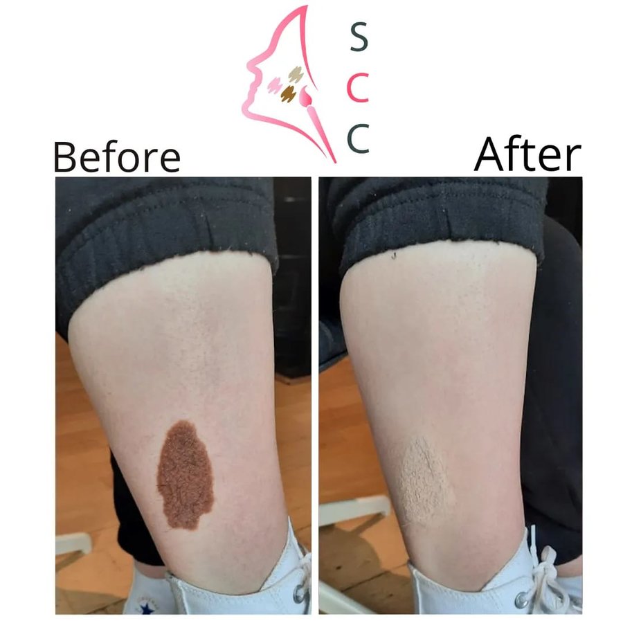 Skin Camouflage Care - Skin Camouflage Care