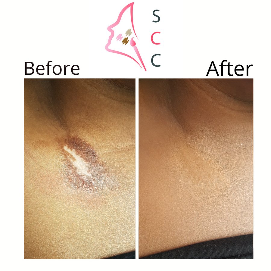 Skin Camouflage Care - Skin Camouflage Care