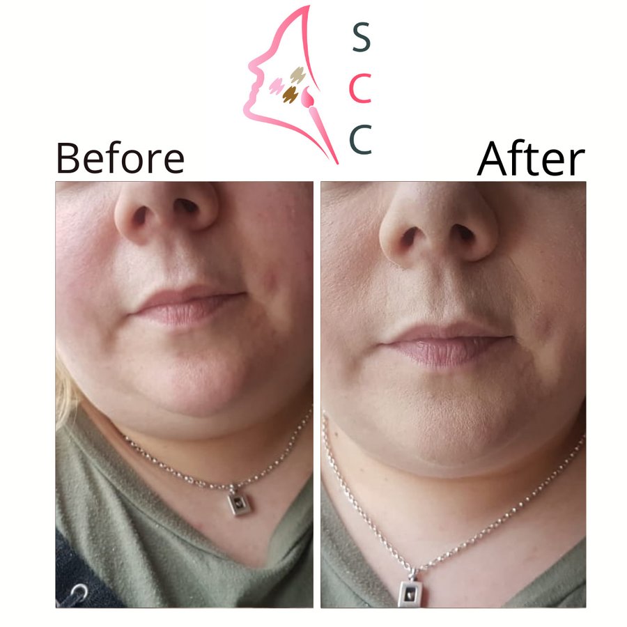 Skin Camouflage Care - Skin Camouflage Care