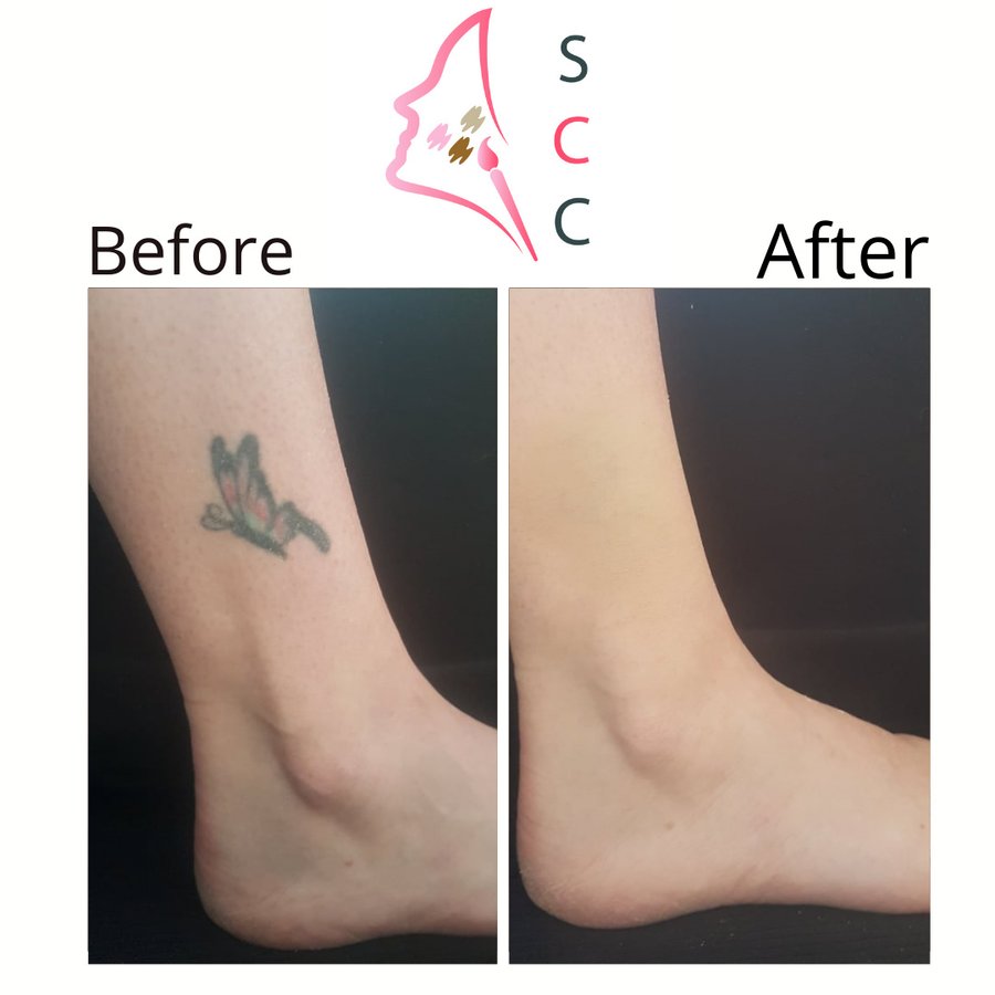 Skin Camouflage Care - Skin Camouflage Care