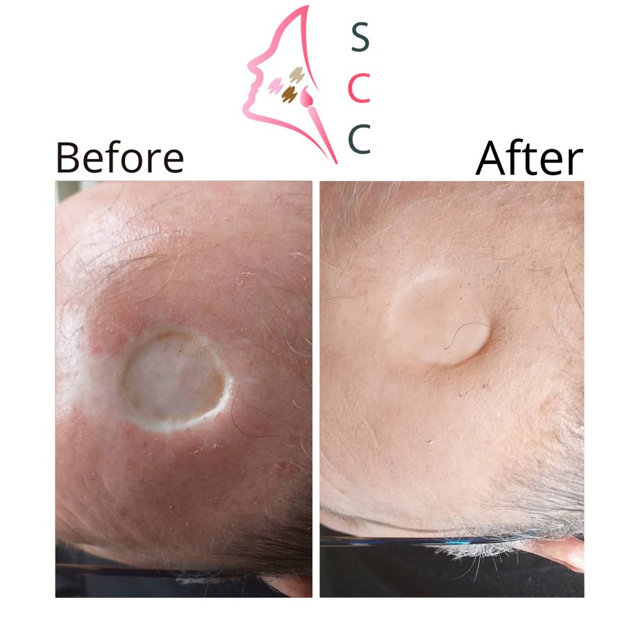 Skin Camouflage Care - Skin Camouflage Care