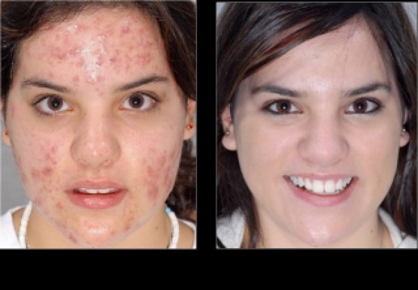 Skin Care Products - Skin Care Products