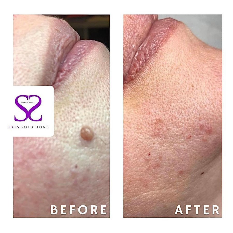 Skin Solutions - Skin Solutions